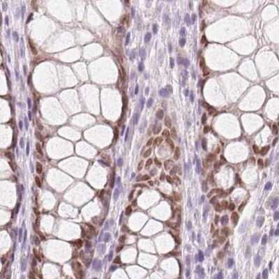 Immunohistochemistry-Paraffin: HOXB13 Antibody [NBP2-49375] - Staining of human colon.