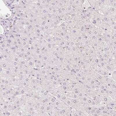 Western Blot: HOXB13 Antibody [NBP2-49375] - Staining of human liver shows low expression as expected.