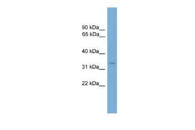 Western Blot: HOXB13 Antibody [NBP3-10405] - Western blot analysis of HOXB13 in Mouse Thymus as a positive control. Antibody dilution at 0.2-1 ug/ml