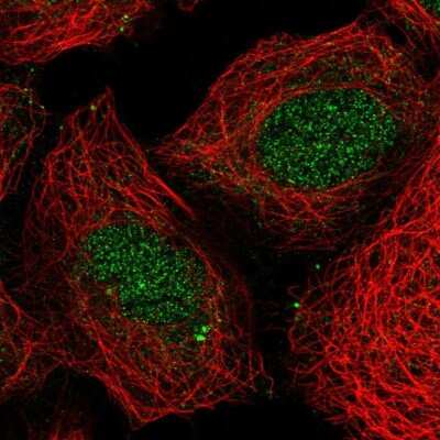 Immunocytochemistry/Immunofluorescence: HOXB4 Antibody [NBP2-33833] - Immunofluorescent staining of human cell line HEK 293 shows localization to nucleus & centrosome.