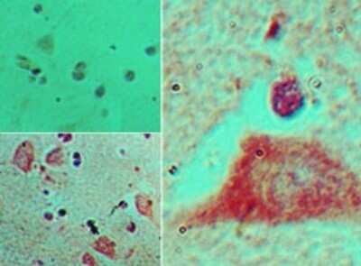 Immunohistochemistry-Paraffin: HOXB4 Antibody [NBP2-24598] - Analysis of HOXB4 in formalin-fixed, paraffin-embedded human brain tissue using an isotype control (top left) and this antibody (bottom left, right) at 5 ug/ml.