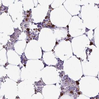 Immunohistochemistry-Paraffin: HOXB4 Antibody [NBP2-33833] - Staining of human bone marrow shows strong positivity in hematopoietic cells.