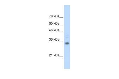 Western Blot: HOXB4 Antibody [NBP3-10514] - Western blot analysis using NBP3-10514 on Transfected 293T  as a positive control. Antibody Titration: 0.2-1 ug/ml