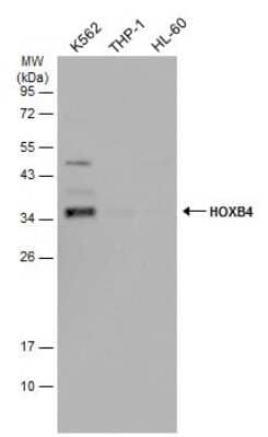 Western Blot: HOXB4 Antibody [NBP3-13347] - Various whole cell extracts (30 ug) were separated by 12% SDS-PAGE, and the membrane was blotted with HOXB4 antibody (NBP3-13347) diluted at 1:1000. The HRP-conjugated anti-rabbit IgG antibody (NBP2-19301) was used to detect the primary antibody.