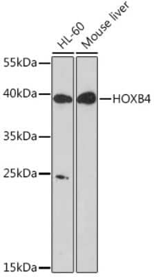 Western Blot: HOXB4 Antibody [NBP3-15493] - Western blot analysis of extracts of various cell lines, using HOXB4 Rabbit pAb (NBP3-15493) at 1:1000 dilution. Secondary antibody: HRP Goat Anti-Rabbit IgG (H+L) at 1:10000 dilution. Lysates/proteins: 25ug per lane. Blocking buffer: 3% nonfat dry milk in TBST. Detection: ECL Basic Kit. Exposure time: 5s.