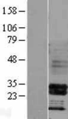 Western Blot HOXB4 Overexpression Lysate