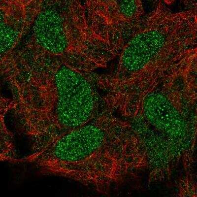 Immunocytochemistry/Immunofluorescence: HOXB5 Antibody [NBP2-57333] - Staining of human cell line A549 shows localization to nucleus. Antibody staining shown in green.