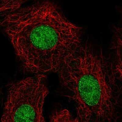 Immunocytochemistry/Immunofluorescence: HOXB5 Antibody [NBP2-68654] - Staining of human cell line A549 shows localization to nucleus. Antibody staining is shown in green.