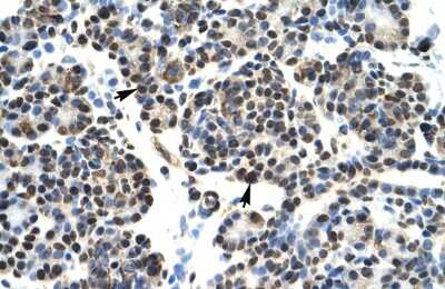 Immunohistochemistry: HOXB5 Antibody [NBP3-10906] - Immunohistochemical analysis of human pancreas lysate.