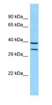 Western Blot: HOXB5 Antibody [NBP1-98351] - Mouse Liver Lysate 1.0ug/ml, gel concentration 12%