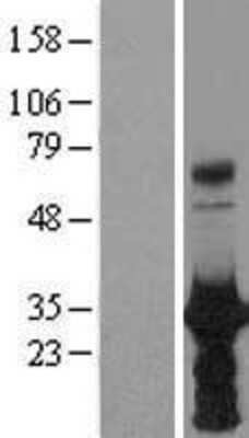 Western Blot: HOXB6 Overexpression Lysate (Adult Normal) [NBL1-11673] Left-Empty vector transfected control cell lysate (HEK293 cell lysate); Right -Over-expression Lysate for HOXB6.