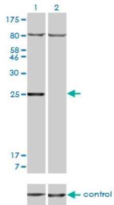 Western Blot: HOXB7 Antibody (5B2) [H00003217-M04] - Western blot analysis of HOXB7 over-expressed 293 cell line, cotransfected with HOXB7 Validated Chimera RNAi or non-transfected control. Blot probed with H00003217-M04. GAPDH (36.1 kDa) used as loading control.