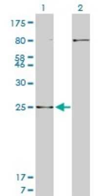 Western Blot: HOXB7 Antibody (5B2) [H00003217-M04] - Analysis of HOXB7 expression in transfected 293T cell line by HOXB7 monoclonal antibody (M04), clone 5B2. Lane 1: HOXB7 transfected lysatE (24 KDa). Lane 2: Non-transfected lysate.