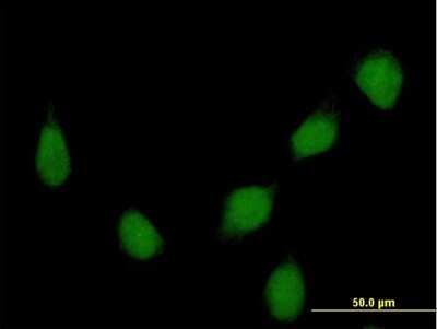 Immunocytochemistry/Immunofluorescence: HOXB7 Antibody [H00003217-D01P] - Analysis of rabbit antibody to HOXB7 on HeLa cell. Antibody concentration 10 ug/ml.