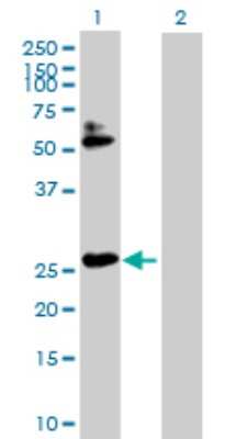 Western Blot: HOXB7 Antibody [H00003217-D01P] - Analysis of HOXB7 expression in transfected 293T cell line by HOXB7 polyclonal antibody.Lane 1: HOXB7 transfected lysate(24.00 KDa).Lane 2: Non-transfected lysate.