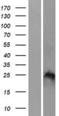 Western Blot: HOXB7 Overexpression Lysate (Adult Normal) [NBP2-07868] Left-Empty vector transfected control cell lysate (HEK293 cell lysate); Right -Over-expression Lysate for HOXB7.