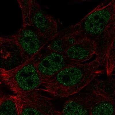 Immunocytochemistry/ Immunofluorescence HOXB8 Antibody - BSA Free