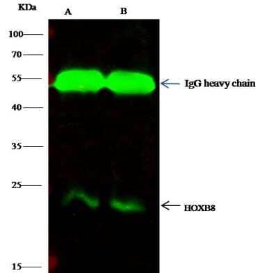 Immunoprecipitation: HOXB8 Antibody [NBP2-98722] - Lane A:0.5 mg HepG2 Whole Cell LysateLane B:0.5 mg 293T Whole Cell Lysate0.5 uL anti-HOXB8 rabbit polyclonal antibody and 60 ug of Immunomagnetic beads Protein G.Primary antibody:Anti-HOXB8 rabbit polyclonal antibody,at 1:500 dilutionSecondary antibody:Dylight 800-labeled antibody to rabbit IgG (H+L), at 1:5000 dilutionDeveloped using the odssey technique.Performed under reducing conditions.Predicted band size: 28 kDaObserved band size: 24 kDa