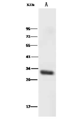 Western Blot: HOXB8 Antibody [NBP2-99554] - Anti-HOXB8 rabbit polyclonal antibody at 1:500 dilution.