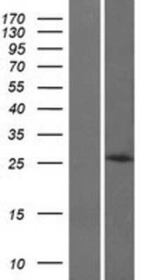 Western Blot HOXB8 Overexpression Lysate