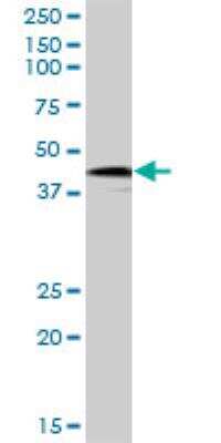 Western Blot: HOXB9 Antibody [H00003219-B01P] - XB9 MaxPab polyclonal antibody. Western Blot analysis of HOXB9 expression in Hela NE.