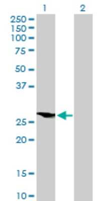 Western Blot: HOXB9 Antibody [H00003219-B01P] - Analysis of HOXB9 expression in transfected 293T cell line by HOXB9 polyclonal antibody.  Lane 1: HOXB9 transfected lysate(27.5 KDa). Lane 2: Non-transfected lysate.