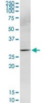 Western Blot: HOXB9 Antibody [H00003219-D03P] - Analysis of HOXB9 expression in K-562.