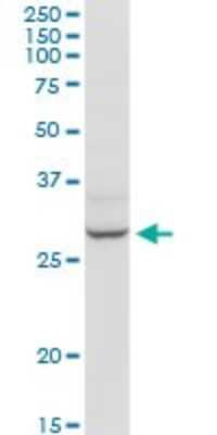 Western Blot: HOXB9 Antibody [H00003219-D03P] - Analysis of HOXB9 expression in human liver.