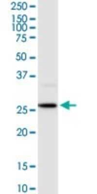 Western Blot: HOXB9 Antibody [H00003219-D03P] - Analysis of HOXB9 expression in mouse liver.
