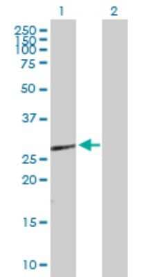 Western Blot: HOXB9 Antibody [H00003219-D03P] - Analysis of HOXB9 expression in transfected 293T cell line by HOXB9 polyclonal antibody.Lane 1: HOXB9 transfected lysate(28.10 KDa).Lane 2: Non-transfected lysate.