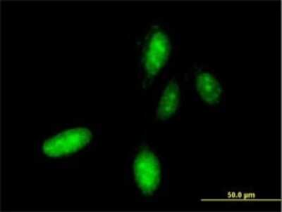 Immunocytochemistry/Immunofluorescence: HOXC10 Antibody (3F2) [H00003226-M01] - Analysis of monoclonal antibody to HOXC10 on HeLa cell . Antibody concentration 10 ug/ml.