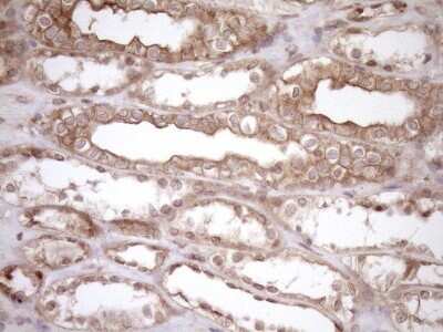 Immunohistochemistry: HOXC10 Antibody (5C10) [NBP2-46000] - Analysis of Human Kidney tissue. (Heat-induced epitope retrieval by 1mM EDTA in 10mM Tris buffer (pH8.5) at 120C for 3 min)(1:150)