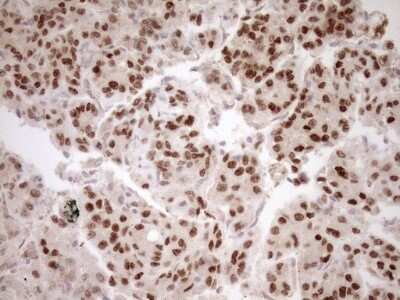 Immunohistochemistry: HOXC10 Antibody (5C10) [NBP2-46000] - Analysis of Human liver tissue. (Heat-induced epitope retrieval by 1mM EDTA in 10mM Tris buffer (pH8.5) at 120C for 3 min)(1:150)