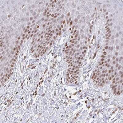 Immunohistochemistry: HOXC10 Antibody [NBP2-33699] - Staining of human vulva/anal skin moderate nuclear positivity in epidermal cells.