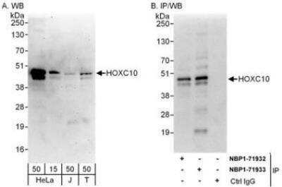 Western Blot: HOXC10 Antibody [NBP1-71933] - Whole cell lysate from HeLa (15 and 50 mcg for WB; 1 mg for IP, 20% of IP loaded), Jurkat (J; 50 mcg) and 293T (T; 50 mcg) cells.  Affinity purified rabbit anti-HOXC10 antibody used for WB at 0.1 mcg/ml (A) and 1 mcg/ml (B) and used for IP at 6 mcg/mg lysate.  HOXC10 was also immunoprecipitated by rabbit anti-HOXC10 antibody NBP1-71932, which recognizes an upstream epitope.