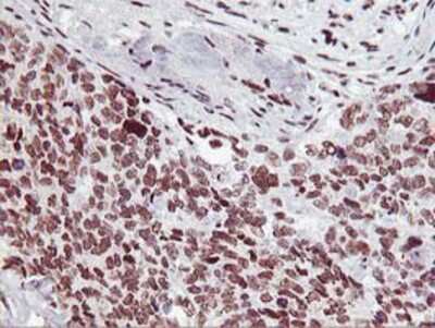 Immunohistochemistry-Paraffin HOXC11 Antibody (OTI3E10)