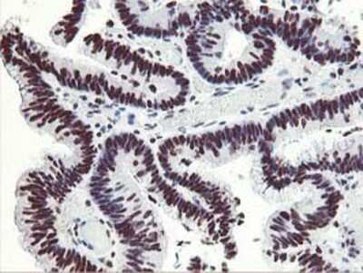 Immunohistochemistry-Paraffin HOXC11 Antibody (OTI3E10)