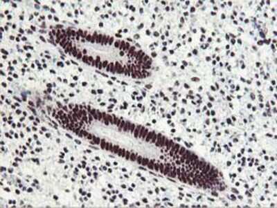 Immunohistochemistry-Paraffin: HOXC11 Antibody (3E10) [NBP2-00499] - Staining of paraffin-embedded Human endometrium tissue using anti-HOXC11 mouse monoclonal antibody.