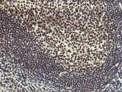 Immunohistochemistry-Paraffin: HOXC11 Antibody (3E10) [NBP2-00499] - Staining of paraffin-embedded Human tonsil using anti-HOXC11 mouse monoclonal antibody.