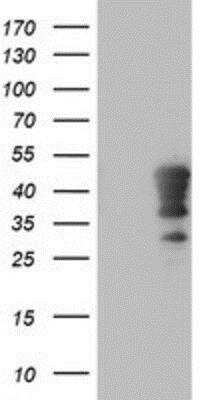 Western Blot: HOXC11 Antibody (3E10) [NBP2-00499] - HEK293T cells were transfected with the pCMV6-ENTRY control (Left lane) or pCMV6-ENTRY HOXC11 (Right lane) cDNA for 48 hrs and lysed. Equivalent amounts of cell lysates (5 ug per lane) were separated by SDS-PAGE and immunoblotted with anti-HOXC11.