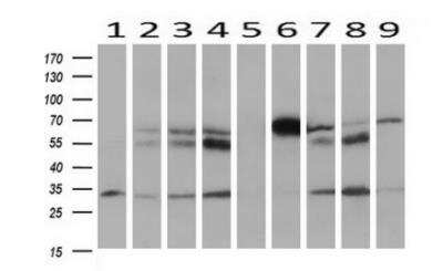 Western Blot: HOXC11 Antibody (3E10) [NBP2-00499] -  Analysis of extracts (10ug) from 9 Human tissue by using anti-HOXC11 monoclonal antibody at 1:200 (1: Testis; 2: Omentum; 3: Uterus; 4: Breast; 5: Brain; 6: Liver; 7: Ovary; 8: Thyroid gland; 9: colon)