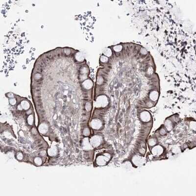 Immunohistochemistry-Paraffin: HOXC11 Antibody [NBP1-83230] - Staining of human small intestine shows strong luminal membranous and nuclear positivity in glandular cells.