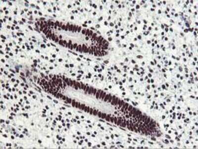 Immunohistochemistry: HOXC11 Antibody (OTI3E10) - Azide and BSA Free [NBP2-70913] - Staining of paraffin-embedded Human endometrium tissue using anti-HOXC11 mouse monoclonal antibody.