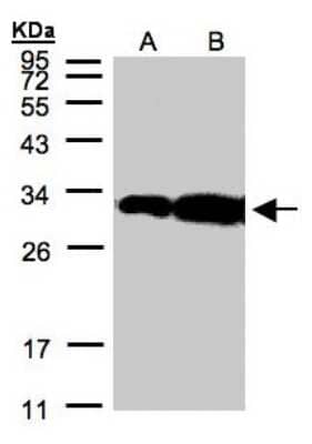 Western Blot: HOXC11 Antibody [NBP1-32331] - Sample(30 ug of whole cell lysate)A:Hep G2 B:MOLT4 12% SDS PAGE, antibody diluted at 1:500.