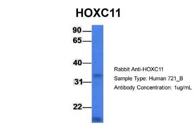 Western Blot: HOXC11 Antibody [NBP2-87591] - Host: Rabbit. Target Name: HOXC11. Sample Type: 721_B. Antibody Dilution: 1.0ug/mlHOXC11 is supported by BioGPS gene expression data to be expressed in 721_B