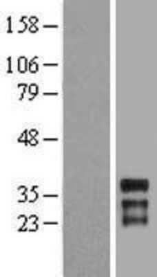 Western Blot HOXC11 Overexpression Lysate