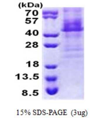 SDS-PAGE Recombinant Human HOXC11 His Protein
