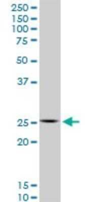 Western Blot: HOXC12 Antibody (1C6) [H00003228-M01] - HOXC12 monoclonal antibody (M01), clone 1C6. Analysis of HOXC12 expression in Raw 264.7.