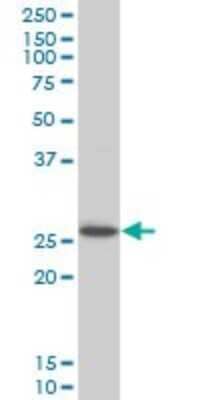 Western Blot: HOXC12 Antibody (1C6) [H00003228-M01] - HOXC12 monoclonal antibody (M01), clone 1C6 Analysis of HOXC12 expression in Jurkat.