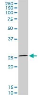 Western Blot: HOXC12 Antibody (2A4) [H00003228-M07] - Analysis of HOXC12 expression in PC-12 (Cat # L012V1).